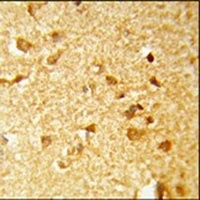 DDX17 Antibody
