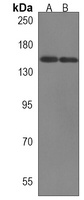 XDH Rabbit Polyclonal Antibody