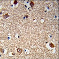 Anti-ACTR5 Antibody