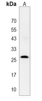 TSPAN6 Antibody
