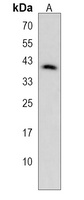 FOXL1 Rabbit Polyclonal Antibody