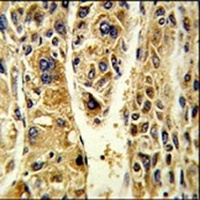 Anti-ADH6 Antibody