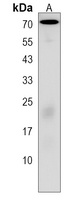 FBXO3 Antibody