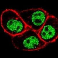 Anti-CDC73 Antibody