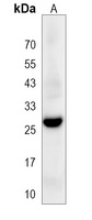 CLRN3 Rabbit Polyclonal Antibody