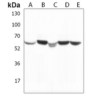 PPM1H Rabbit Polyclonal Antibody