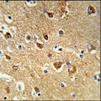 PPM1H Rabbit Polyclonal Antibody
