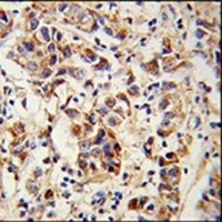 Anti-SPRR1B Antibody