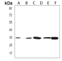 OR2H2 Rabbit Polyclonal Antibody