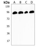 DPP10 Rabbit Polyclonal Antibody