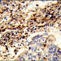 Anti-CXorf22 Antibody