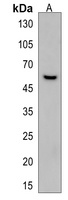 DAB2 Rabbit Polyclonal Antibody