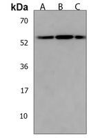 PPP1R36 Rabbit Polyclonal Antibody