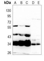 EMX1 Rabbit Polyclonal Antibody
