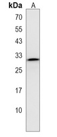 ZFP36 Rabbit Polyclonal Antibody