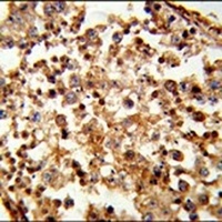 Anti-C1QTNF6 Antibody