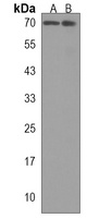 ALOX12 Rabbit Polyclonal Antibody
