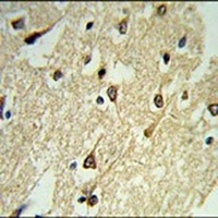 Anti-Adenylate Cyclase 8 Antibody