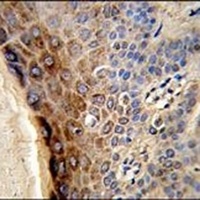 Anti-CTHRC1 Antibody