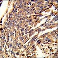 Anti-ARPC1B Antibody