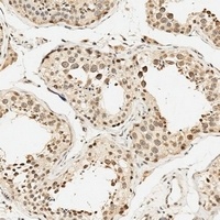 Anti-HSPA7 Antibody