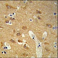 Anti-TSPAN12 Antibody