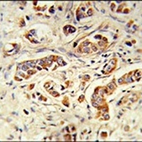 NCF1C Rabbit Polyclonal Antibody