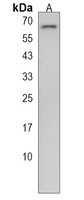 Cytochrome P450 4F3 Antibody