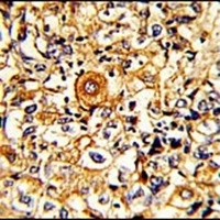 Anti-PTAR1 Antibody