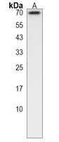 LMOD1 Rabbit Polyclonal Antibody
