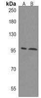 ANO5 Rabbit Polyclonal Antibody