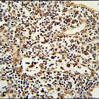 Anti-ANO5 Antibody