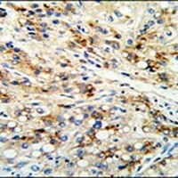 Anti-CECR5 Antibody