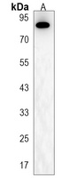 CCHCR1 Rabbit Polyclonal Antibody