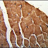CCHCR1 Rabbit Polyclonal Antibody
