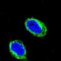 CCHCR1 Rabbit Polyclonal Antibody