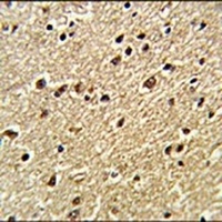 Anti-ZNF823 Antibody