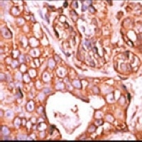 PPM1F Antibody