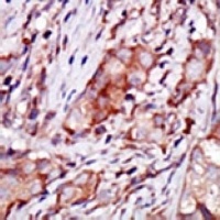 Anti-CIB2 Antibody