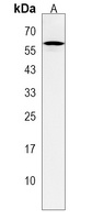 PFKFB4 Rabbit Polyclonal Antibody