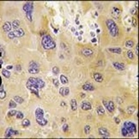 Anti-PFKFB1 Antibody