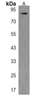 ARHGAP26 Rabbit Polyclonal Antibody