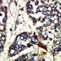 Anti-NEK1 Antibody