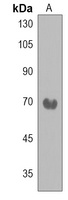 NEK11 Rabbit Polyclonal Antibody