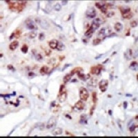 Anti-PIP4K2C Antibody