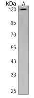 PKN2 Antibody