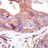 Anti-PKN2 Antibody