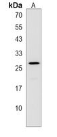 PRKCDBP Antibody