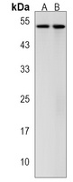 STYK1 Rabbit Polyclonal Antibody