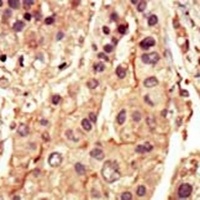 Anti-SRMS Antibody